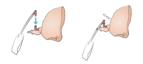 Laerdal Luftväg Baby Anne anslutning